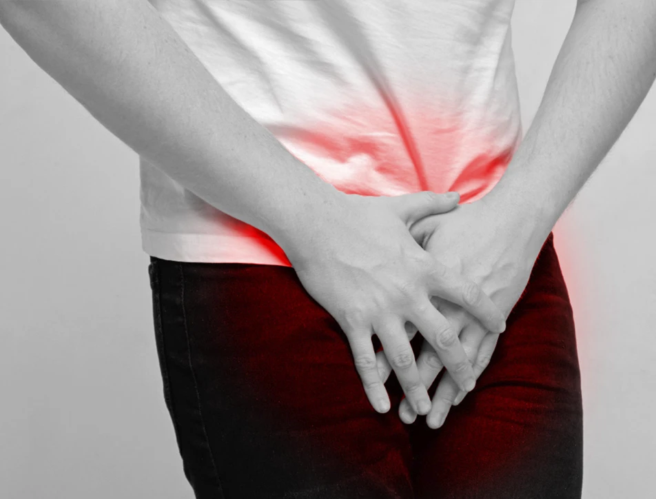 Hiperplasia Prostática